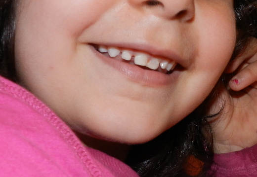 12-05-22-wichtelchor-015